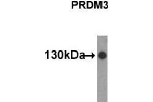 Western Blotting (WB) image for anti-MDS1 and EVI1 Complex Locus (MECOM) (N-Term) antibody (ABIN356376) (MECOM anticorps  (N-Term))