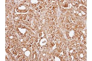 IHC-P Image Immunohistochemical analysis of paraffin-embedded NCI-N87 xenograft, using RPL13A, antibody at 1:100 dilution. (RPL13A anticorps)