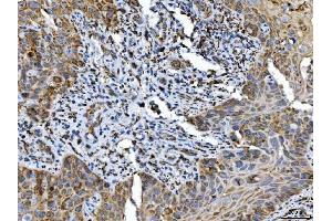 IHC analysis of ALDH1B1 using anti-ALDH1B1 antibody (ABIN4886450).