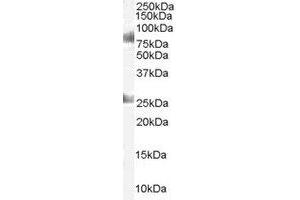 Image no. 1 for anti-Chromodomain Protein, Y-Like (CDYL) (AA 586-598) antibody (ABIN292570) (CDYL anticorps  (AA 586-598))