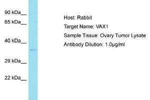 Host: Rabbit Target Name: VAX1 Sample Tissue: Human Ovary Tumor Antibody Dilution: 1ug/ml (VAX1 anticorps  (N-Term))