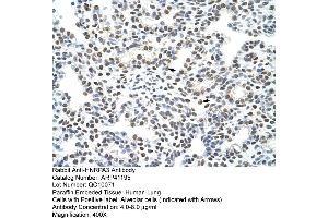 Rabbit Anti-HNRPA3 Antibody  Paraffin Embedded Tissue: Human Lung Cellular Data: Alveolar cells Antibody Concentration: 4.