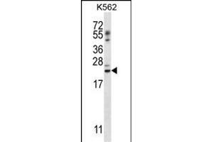 PSORS1C1 Antibody (N-term) (ABIN657118 and ABIN2846264) western blot analysis in K562 cell line lysates (35 μg/lane). (PSORS1C1 anticorps  (N-Term))