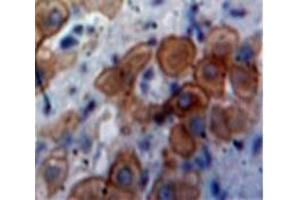 Used in DAB staining on fromalin fixed paraffin-embedded Liver tissue