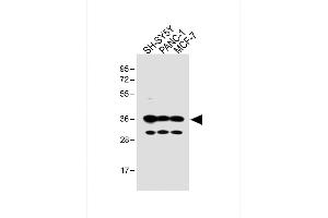 All lanes : Anti-OR5V1 Antibody (C-term) at 1:1000 dilution Lane 1: SH-SY5Y whole cell lysate Lane 2: NC-1 whole cell lysate Lane 3: MCF-7 whole cell lysate Lysates/proteins at 20 μg per lane. (OR5V1 anticorps  (C-Term))