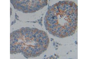 Used in DAB staining on fromalin fixed paraffin- embedded Kidney tissue (KEL anticorps  (AA 439-713))