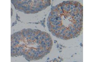 Used in DAB staining on fromalin fixed paraffin- embedded Kidney tissue