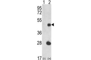 Western Blotting (WB) image for anti-LUC7-Like (LUC7L) antibody (ABIN3002860)