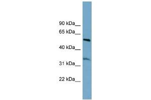 WB Suggested Anti-THNSL2 Antibody Titration: 0. (THNSL2 anticorps  (Middle Region))
