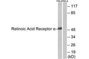 Western blot analysis of extracts from HeLa cells, using Retinoic Acid Receptor alpha (Ab-77) Antibody. (Retinoic Acid Receptor alpha anticorps  (AA 46-95))