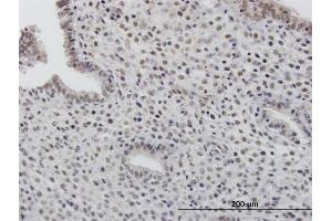 Immunoperoxidase of purified MaxPab antibody to TOB1 on formalin-fixed paraffin-embedded human endometrium.