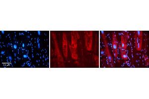Rabbit Anti-SIRT5 Antibody    Formalin Fixed Paraffin Embedded Tissue: Human Adult heart  Observed Staining: Cytoplasmic Primary Antibody Concentration: 1:600 Secondary Antibody: Donkey anti-Rabbit-Cy2/3 Secondary Antibody Concentration: 1:200 Magnification: 20X Exposure Time: 0. (SIRT5 anticorps  (Middle Region))