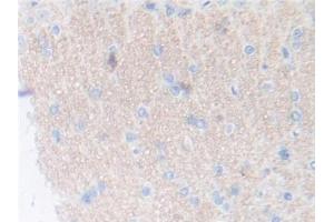 DAB staining on IHC-P; Samples: Rat Cerebrum Tissue