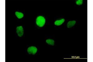 Immunofluorescence of purified MaxPab antibody to ZFP161 on HeLa cell. (ZBTB14/ZFP161 anticorps  (AA 1-449))