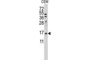 Western Blotting (WB) image for anti-LSM1 Homolog, U6 Small Nuclear RNA Associated (LSM1) antibody (ABIN3001679) (LSM1 anticorps)