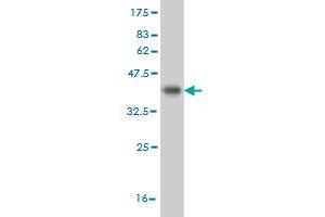 Western Blot detection against Immunogen (35. (CDK8 anticorps  (AA 375-464))
