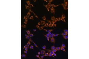 Immunofluorescence analysis of NIH/3T3 cells using R antibody (ABIN6132582, ABIN6146672, ABIN6146673 and ABIN6222096) at dilution of 1:100. (RAMP1 anticorps  (AA 27-117))