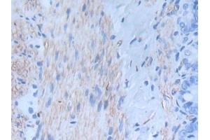 Detection of INHbA in Rat Intestine Tissue using Monoclonal Antibody to Inhibin Beta A (INHbA)