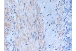 Detection of INHbA in Rat Intestine Tissue using Monoclonal Antibody to Inhibin Beta A (INHbA) (INHBA anticorps  (AA 314-424))