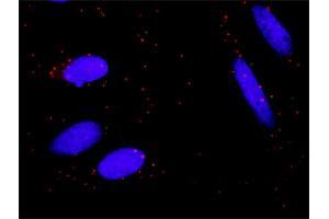 Proximity Ligation Analysis of protein-protein interactions between MAP3K7 and CHUK.