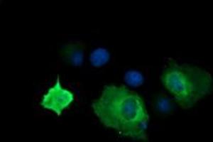 Image no. 2 for anti-Cancer/testis Antigen 1B (CTAG1B) antibody (ABIN1499901) (CTAG1B anticorps)