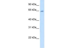 Western Blotting (WB) image for anti-Steroid Sulfatase (Microsomal), Isozyme S (STS) antibody (ABIN2462461) (STS anticorps)