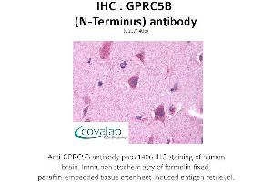 Image no. 1 for anti-G Protein-Coupled Receptor, Family C, Group 5, Member B (GPRC5B) (Extracellular Domain), (N-Term) antibody (ABIN1735216) (GPRC5B anticorps  (Extracellular Domain, N-Term))