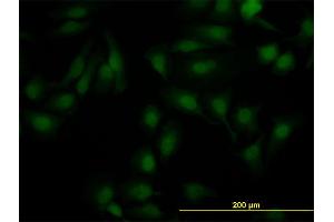 Immunofluorescence of monoclonal antibody to NR1H2 on HeLa cell. (NR1H2 anticorps  (AA 1-461))