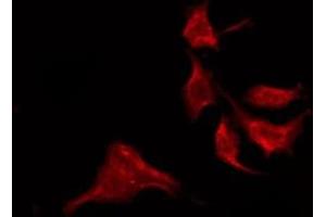 ABIN6275154 staining Hela by IF/ICC.