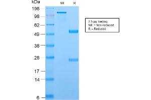 SDS-PAGE Analysis Purified TCL1 Recombinant Rabbit Monoclonal Antibody (TCL1/2747R). (Recombinant TCL1A anticorps  (AA 2-109))