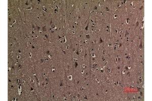 Immunohistochemistry (IHC) analysis of paraffin-embedded Human Brain, antibody was diluted at 1:100.
