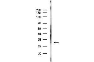 anti-Myozenin 2 (MYOZ2) (Internal Region) antibody