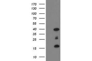 Western Blotting (WB) image for anti-PDZ and LIM Domain 2 (PDLIM2) antibody (ABIN1500124) (PDLIM2 anticorps)
