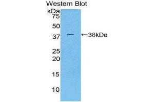 Western Blotting (WB) image for anti-Signal Transducing Adaptor Family Member 1 (STAP1) (AA 1-297) antibody (ABIN1860644) (STAP1 anticorps  (AA 1-297))