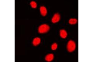 Immunofluorescent analysis of 53BP1 staining in HeLa cells.