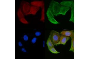 ABIN6258446 and ABIN6274906 staining Hela cells(30 min of UV treatment) by IF/ICC.