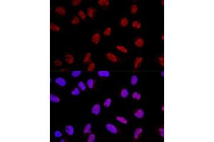 Confocal immunofluorescence analysis of U2OS cells using  Polyclonal Antibody (ABIN3017254, ABIN3017255, ABIN3017256 and ABIN6220015) at dilution of 1:200.