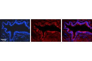 Rabbit Anti-PA2G4 Antibody     Formalin Fixed Paraffin Embedded Tissue: Human Bronchial Epithelial Tissue  Observed Staining: Cytoplasmic  Primary Antibody Concentration: 1:100  Secondary Antibody: Donkey anti-Rabbit-Cy3  Secondary Antibody Concentration: 1:200  Magnification: 20X  Exposure Time: 0. (PA2G4 anticorps  (C-Term))