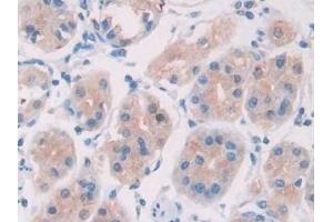 Detection of IL28A in Human Stomach Tissue using Monoclonal Antibody to Interleukin 28A (IL28A)