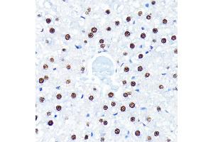 Immunohistochemistry of paraffin-embedded rat liver using HuR/EL antibody (ABIN7266913) at dilution of 1:100 (40x lens).