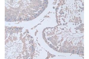 Detection of IFNg in Rat Testis Tissue using Polyclonal Antibody to Interferon Gamma (IFNg)