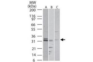 Western blot analysis of RTN4R in A) human, B) mouse and C) rat brain tissue lysate. (RTN4R anticorps  (AA 50-100))