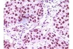 Immunohistochemistry (IHC) image for anti-Lysine (K)-Specific Demethylase 1A (KDM1A) (truncated) antibody (ABIN2464078)