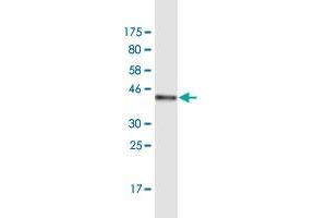 Western Blot detection against Immunogen (44.