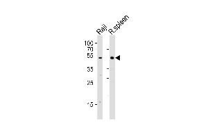 Western blot analysis of lysates from Raji cell line and rat spleen tissue lysate(from left to right), using Mouse Lyn Antibody (Center) (ABIN6243396 and ABIN6577552).