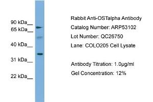 WB Suggested Anti-OSTalpha  Antibody Titration: 0.