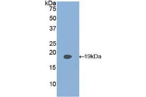 Western blot analysis of recombinant Human PLAA. (PLAA anticorps  (AA 162-312))