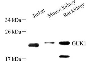 Western blot analysis of GUK1 (ABIN7074153) at dilution of 1: 500 (GUK1 anticorps)