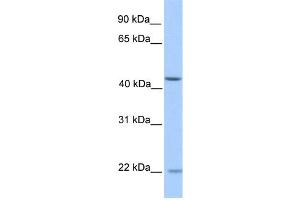 WB Suggested Anti-ZNF485 Antibody Titration:  0. (ZNF485 anticorps  (N-Term))