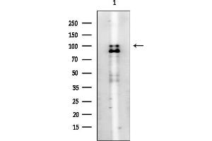 anti-Aconitase 1 (ACO1) antibody